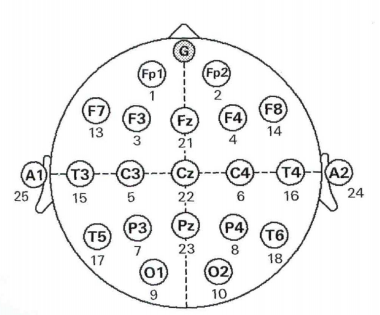 Neurofeedback_EEG_Ableitsystem.png